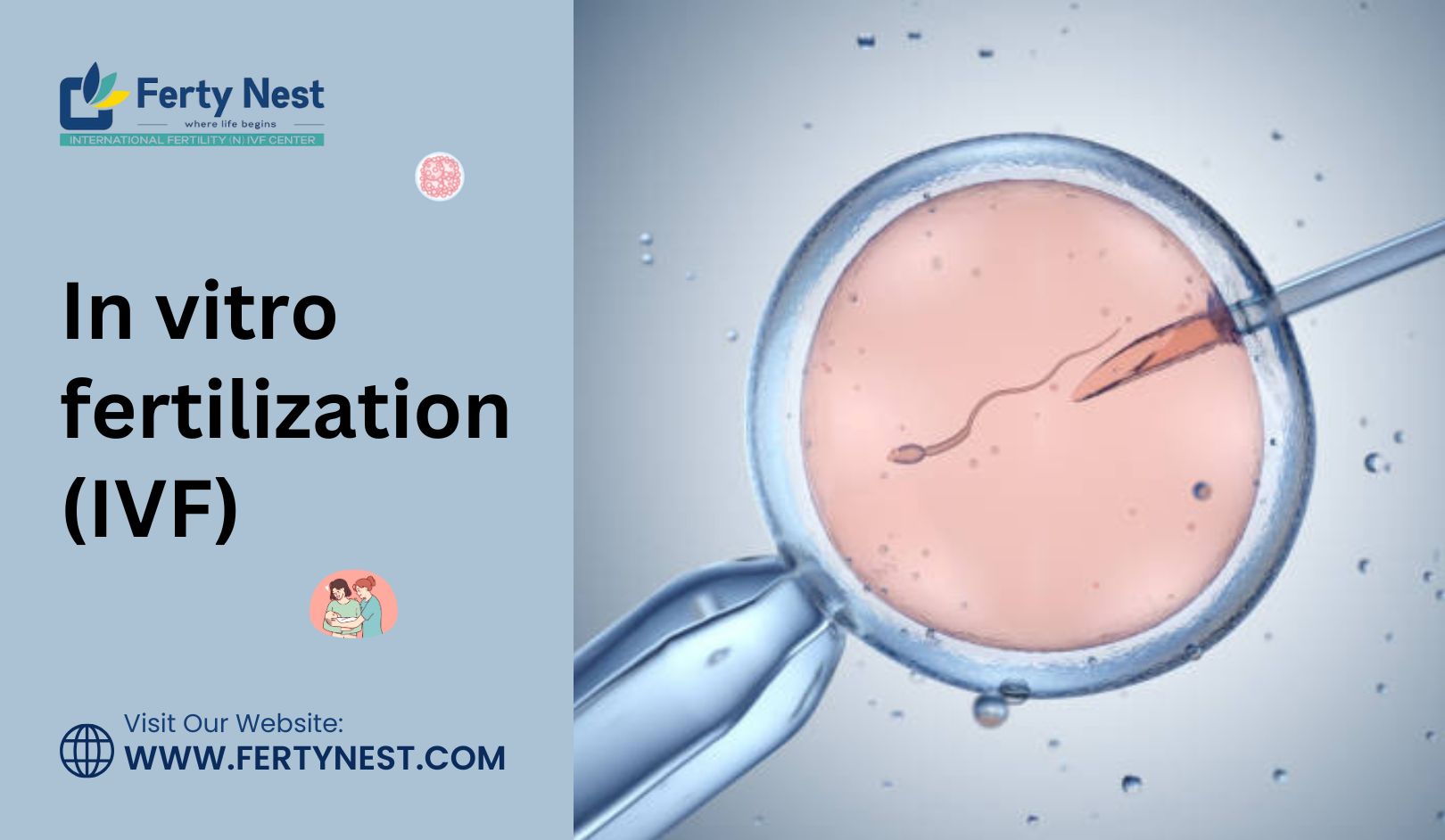 In Vitro Fertilization (IVF)